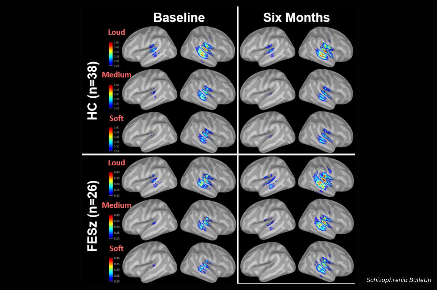 Schizophrenia Bulletin Longitudinal Investigation Of Auditory Dynamic